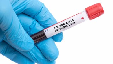 FDA aprueba el autoinyector de belimumab para el tratamiento del lupus eritematoso sistémico pediátrico