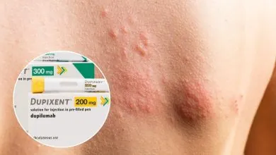 FDA aprueba Dupixent para urticaria crónica espontánea: Sanofi y Regeneron logran séptima indicación del biológico