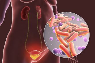FDA aprueba Pivya: Nuevo tratamiento para infecciones del tracto urinario no complicadas
