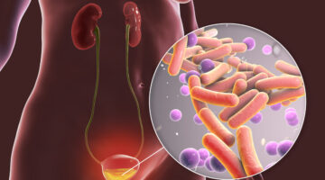 FDA aprueba Pivya: Nuevo tratamiento para infecciones del tracto urinario no complicadas