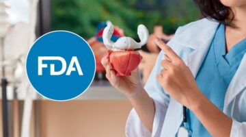 FDA aprueba medicamento de Johnson & Johnson: un nuevo enfoque para el cáncer de vejiga no músculo-invasivo