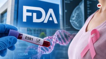 FDA aprueba nueva terapia para cáncer de mama con mutación ESR1