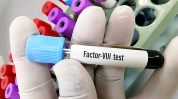 FDA aprueba primera terapia génica para hemofilia A