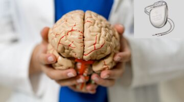 FDA aprueba terapia DBS adaptativa en párkinson