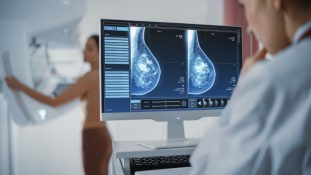 Fragmentación de la atención aumenta un 33% el riesgo de morir por cáncer de mama en Colombia