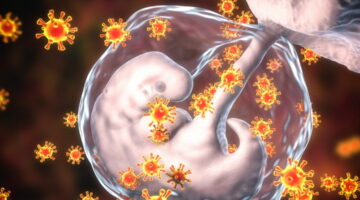 HERPES PERINATAL