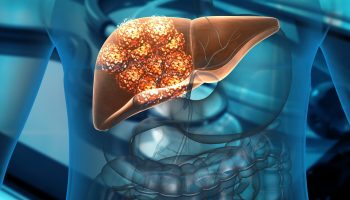 Hallan posible combinación de inmunoterapia para tratar el cáncer de hígado