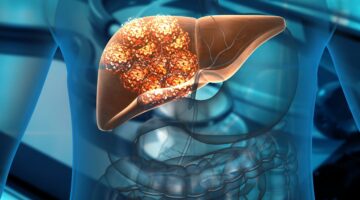 Hallan posible combinación de inmunoterapia para tratar el cáncer de hígado