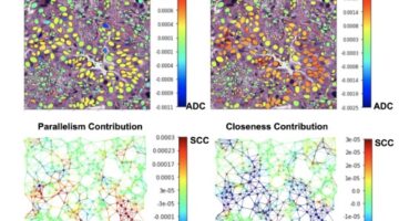 IA predice con exactitud los resultados del cáncer desde el análisis de tejidos Fuente Nature