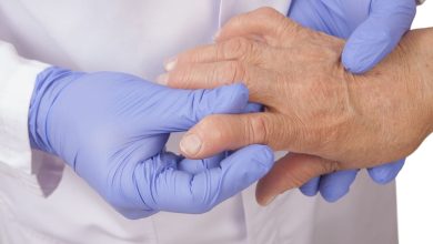 Impacto económico de la optimización de terapias biológicas en artritis reumatoide y espondiloartritis
