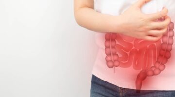 Inflamación intestinal de bajo grado a largo plazo después de radioterapia