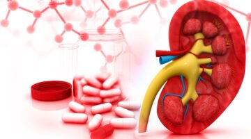 Inhibidores SGLT-2 y la reducción del riesgo de cálculos renales en pacientes con diabetes tipo 2 ¿un nuevo beneficio