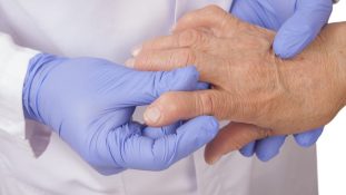 Innovación y ciencia la respuesta del avance médico en reumatología