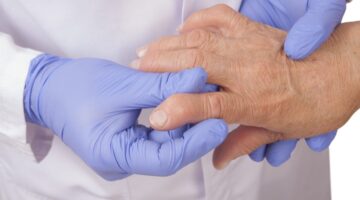 Innovación y ciencia la respuesta del avance médico en reumatología