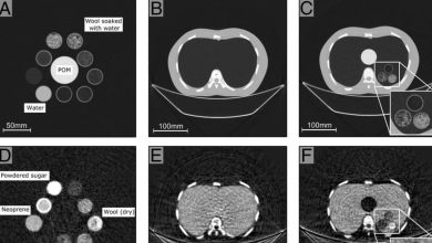Integran tecnología de rayos X en tomografía computarizada