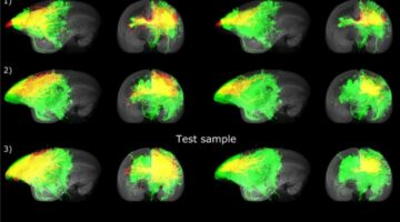 Inteligencia artificial mapeo cerebral