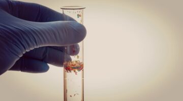 Investigación detecta microplásticos en tejidos cardiovasculares tras cirugías