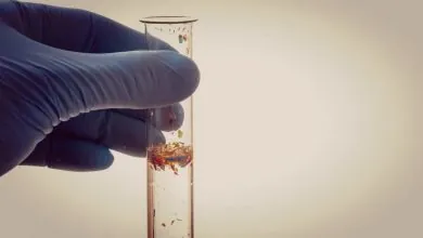 Investigación detecta microplásticos en tejidos cardiovasculares tras cirugías