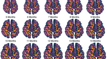 Investigadores revelan nuevos atlas del cerebro infantil, mes a mes