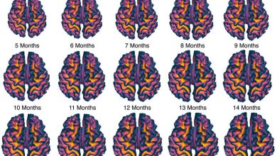Investigadores revelan nuevos atlas del cerebro infantil, mes a mes