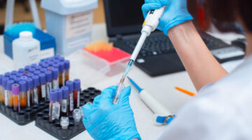 Investigadores revelan primer caso de VIH que resiste antirretrovirales