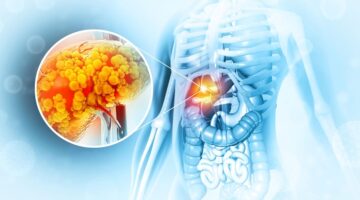 La FDA aprueba Rezdiffra como tratamiento para cicatrices hepáticas debido a la enfermedad del hígado graso