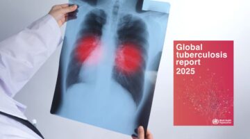 La OMS alerta estancamiento mundial en tuberculosis las metas del 2025 ya están fuera del alcance