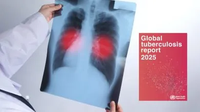 La OMS alerta estancamiento mundial en tuberculosis las metas del 2025 ya están fuera del alcance