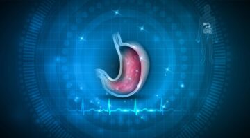 La importancia de erradicar H. pylori si historia familiar de cáncer gástrico