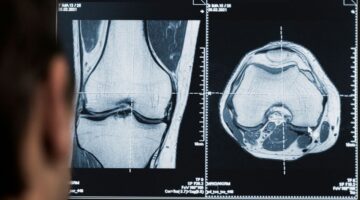 La radiología, un factor clave en la innovación de la salud