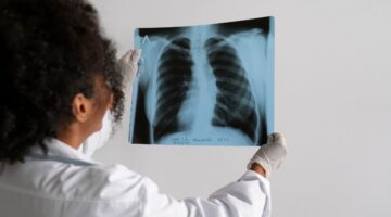 La tuberculosis resurge como principal causa de muerte por enfermedad infecciosa: OMS