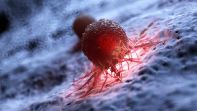 Laminina, proteína clave para detener la progresión de los tumores de mama