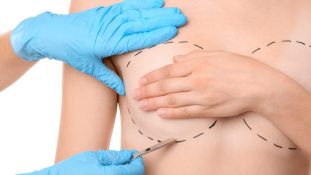 Ley 2194 de 2022 - Eliminación de barreras para el tratamiento del cáncer de mama aprueban reconstrucción de ambos senos