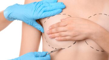 Ley 2194 de 2022 - Eliminación de barreras para el tratamiento del cáncer de mama aprueban reconstrucción de ambos senos