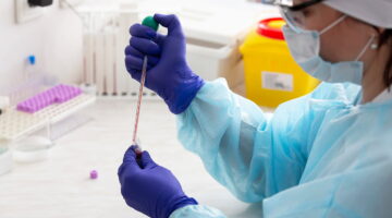 Ligera tendencia a la reducción de casos de viruela símica: Gobierno Méxicano