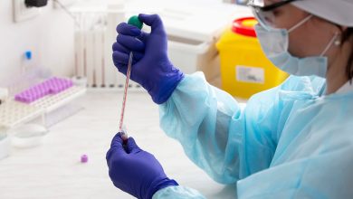 Ligera tendencia a la reducción de casos de viruela símica: Gobierno Méxicano