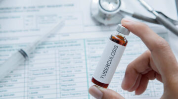 Lineamientos para el Programa Nacional de Prevención y Control de la Tuberculosis –PNPCT-