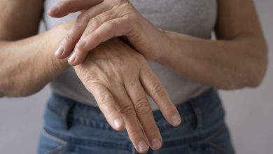 Lo que debes saber de la artritis