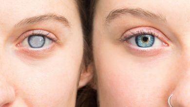 Lo que debes saber sobre el Glaucoma