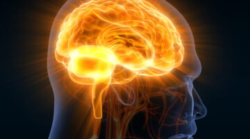 Lo que debes saber sobre la encefalitis inflamación del cerebro