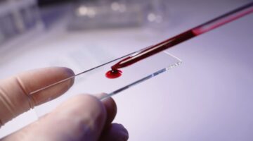 MAESTRO técnica capaz de detectar 10.000 mutaciones de cáncer