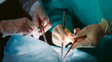 Más de 6 mil peruanos se encuentran en espera de un trasplante de órganos