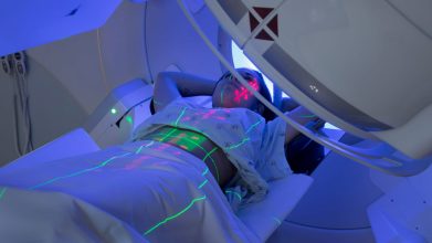 Más de la mitad de los pacientes con cáncer requieren radioterapia
