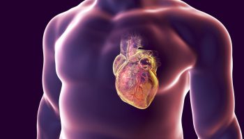 Mejora de la predicción de riesgo genético para enfermedades cardíacas mediante el uso de datasets más diversos