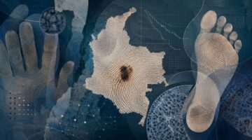 Melanoma acral concentra 32 de los casos en Colombia y 42,4 de supervivencia ok
