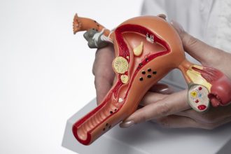 México: cáncer de ovario puede ser curable en el 90% de los casos si se detecta en etapa inicial