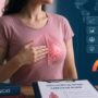 Modelos internacionales de riesgo de cáncer de mama precisión limitada en mujeres con antecedente familiar Modelos internacionales de riesgo de cáncer de mama: precisión limitada en mujeres con antecedente familiar