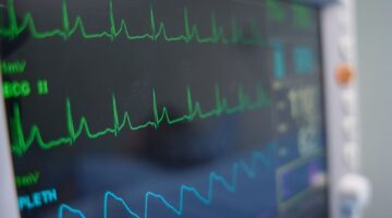 Monitoreo de pacientes graves con hemopatías malignas por uso de células CAR-T