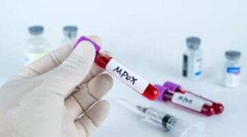 Mpox evaluación y respuesta global ante la emergencia sanitaria internacional
