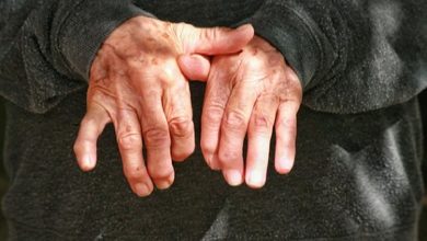 Mujeres, más afectadas por artritis reumatoide en Colombia
